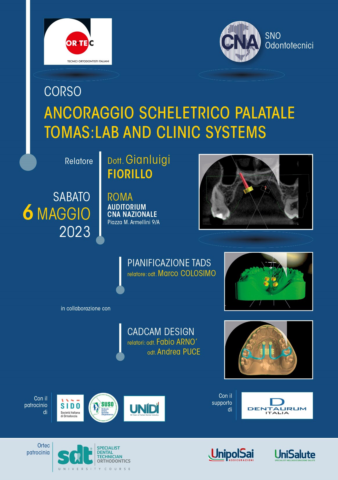 Ancoraggio scheletrico palatale Tomas: Lab and Clinic Systems
